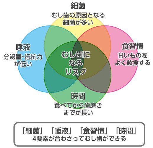 虫歯は虫歯菌だけが原因なの？