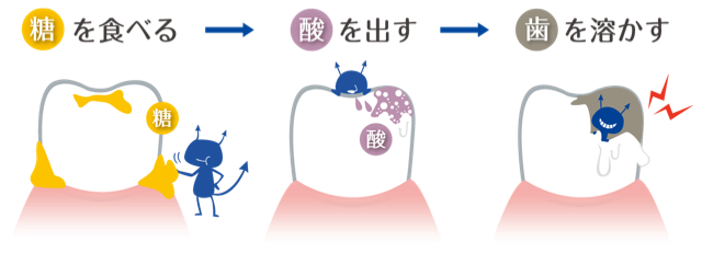 おすすめの歯磨き粉