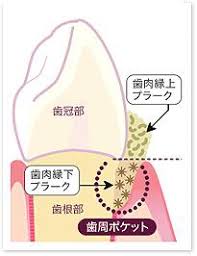 それぞれの症状