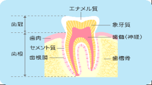 むし歯ではないのに歯が溶けてしまう 川口の歯医者 赤羽歯科川口診療所